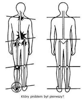 na powstanie skoliozy ma wpływ symetria skrzywienie kręgosłupa 